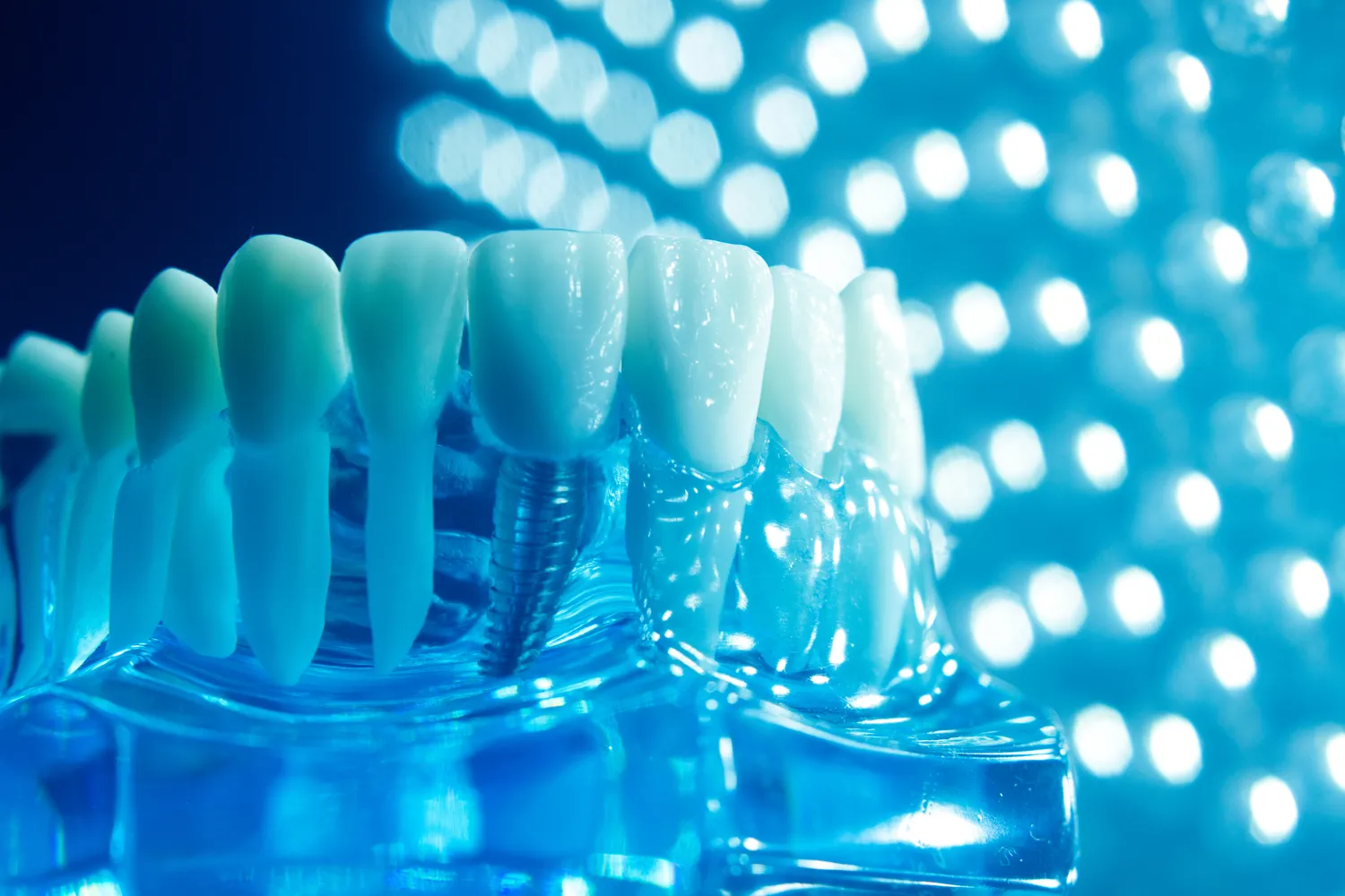 Protetyka stomatologiczna Szczecin