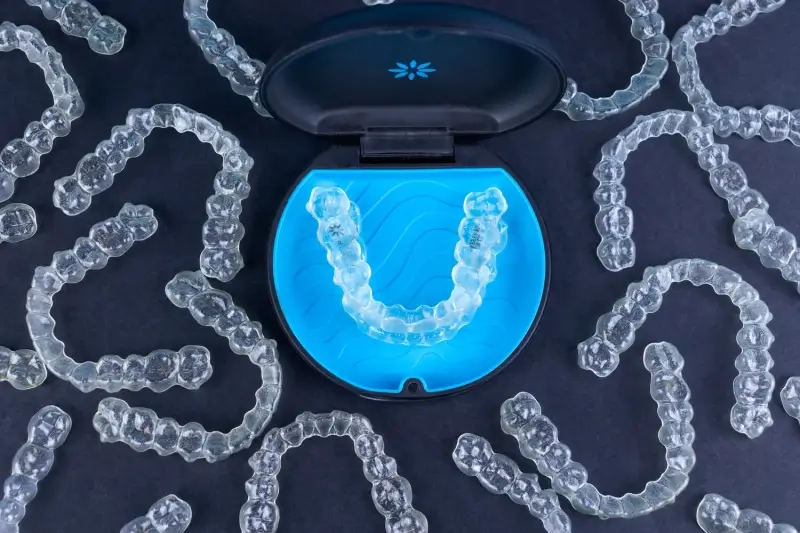 Ile kosztuje Invisalign w Polsce?