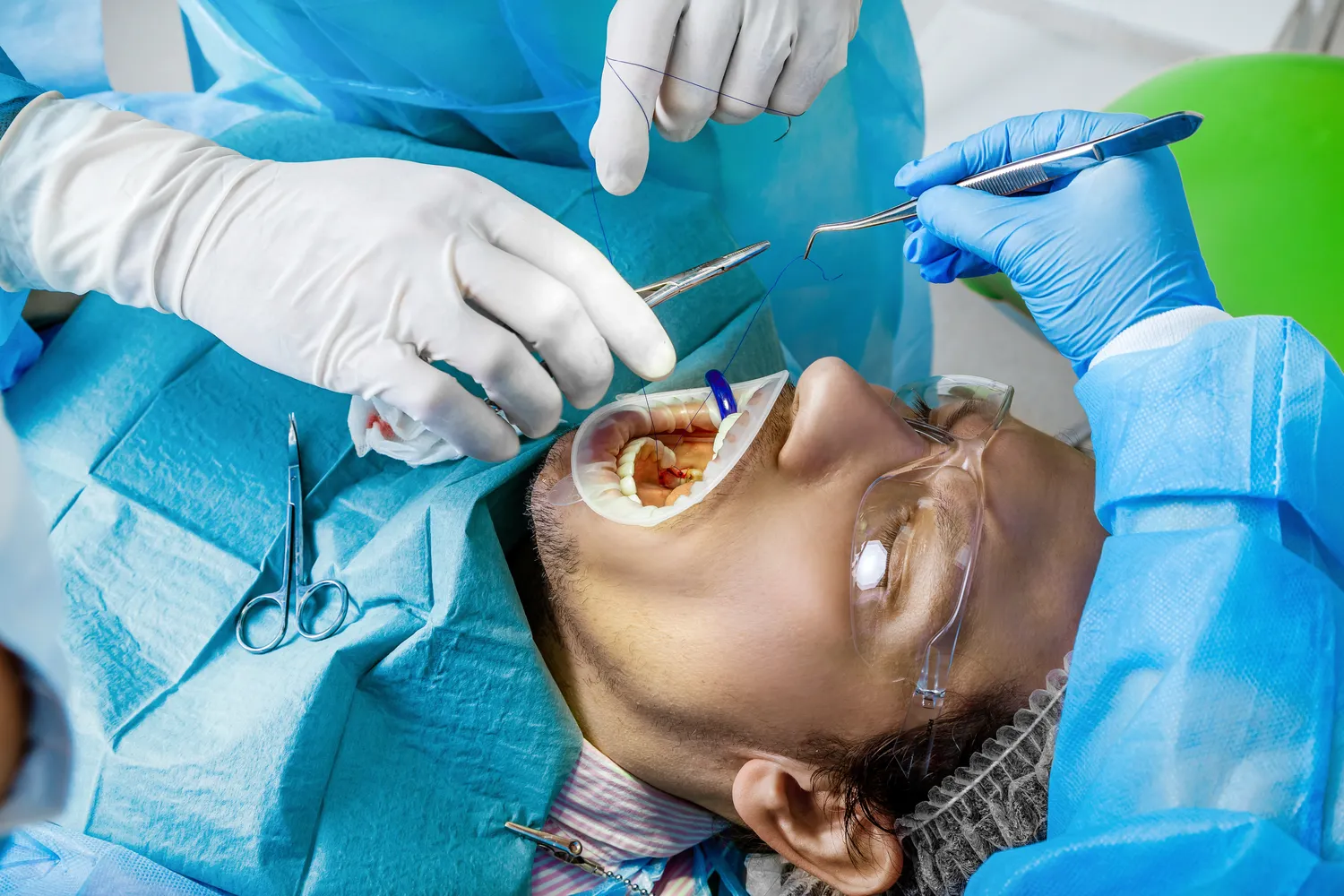 Rodzaje implantów zębowych