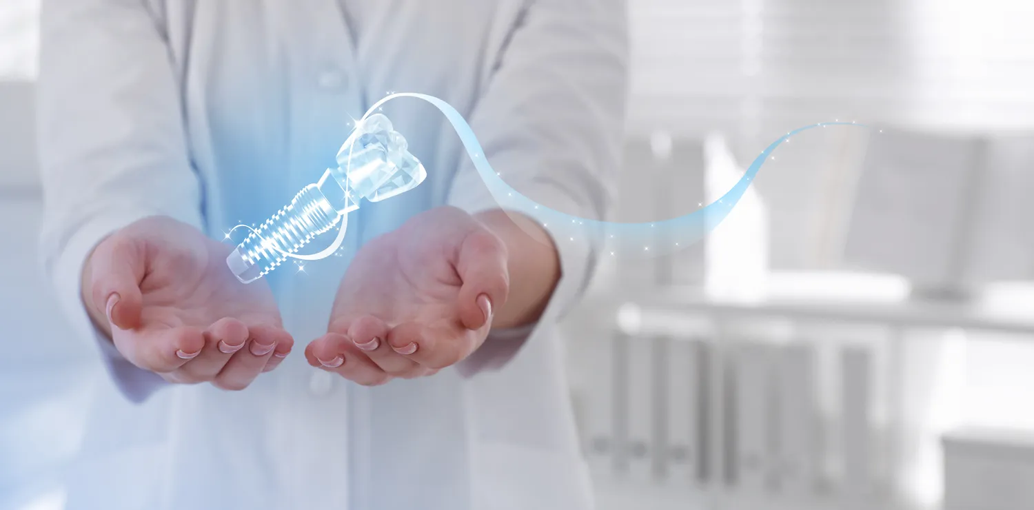 Zęby implanty - ile kosztują?