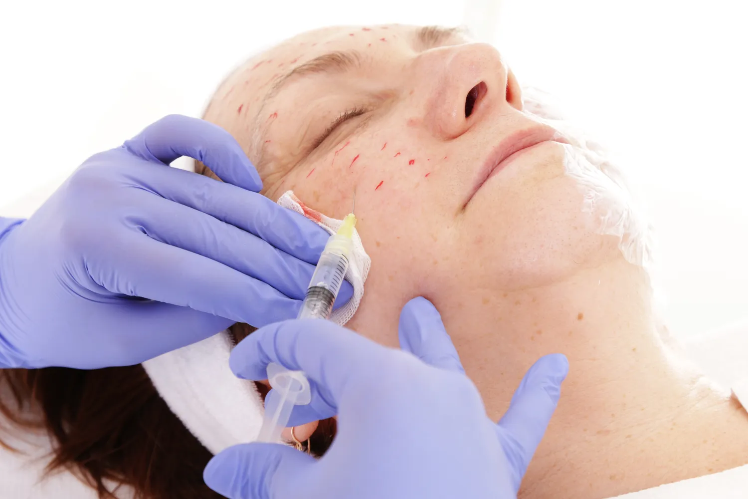 Dlaczego kwas hialuronowy szybko się wchłania?