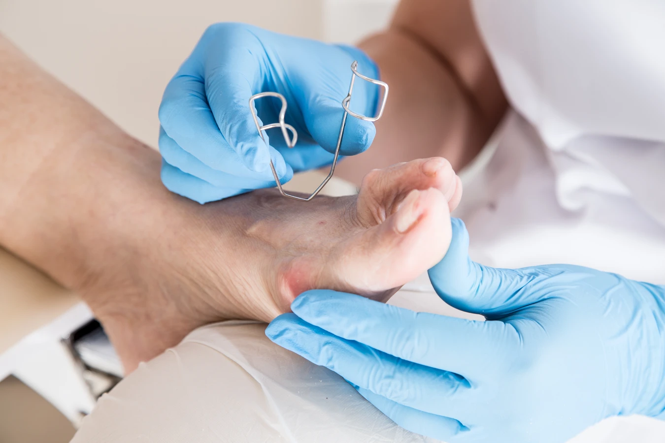  Pedicure leczniczy - co o nim wiedzieć warto?