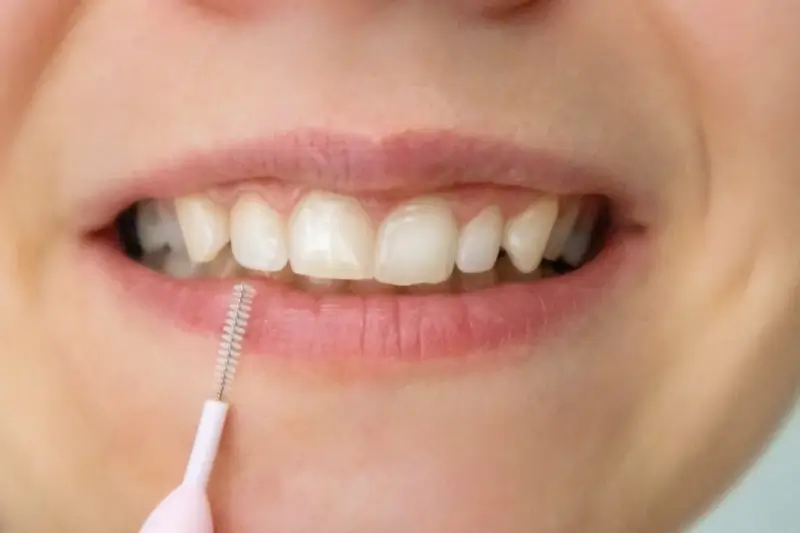 Leczenie kanałowe Szczecin gdzie najlepiej